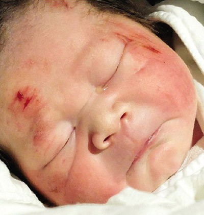 Ảnh minh họa. Ảnh minh họa.