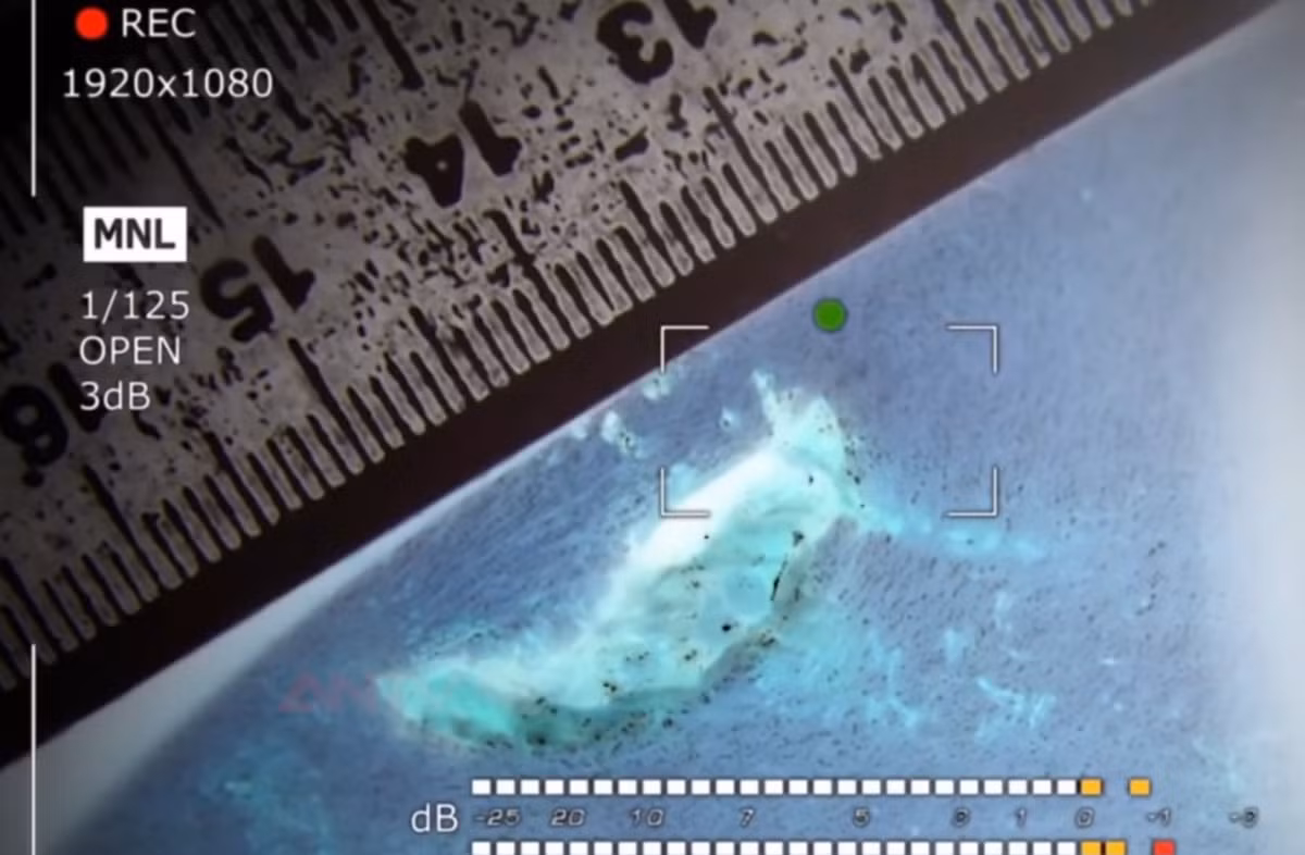 Khám nghiệm tử thi xác định ông Nhất bị bắn 1 phát vào hông bên phải, đạn xuyên qua hông trái làm tổn thương vùng nội tạng khiến ông tử vong tại chỗ.