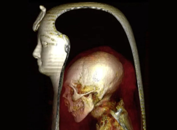 Kham pha ky thuat xu ly xac uop doc dao cua nguoi Ai Cap