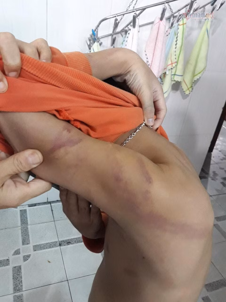 Nguoi cha danh con chang chit vet bam tim vi 'tiep thu bai cham'