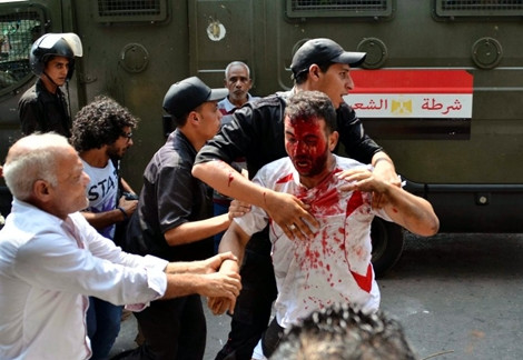 Cảnh sát Ai Cập dẹp bỏ lêu trại của những người biểu tình ủng hộ Tổng thống bị lật đổ Mohamed Mursi, hơn 120 người thương vong.