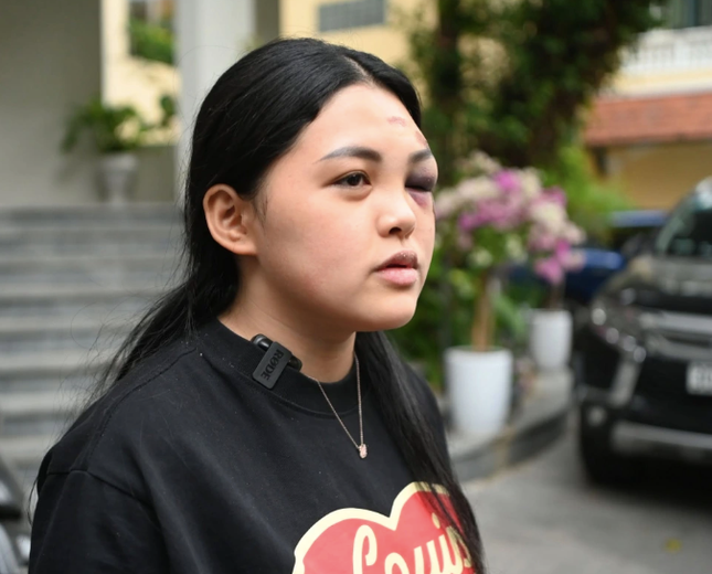 Xet xu 'nu quai' dua xe, tong chet co gai dung cho den do