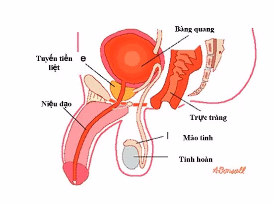 Ung thư tuyến tiền liệt (ảnh minh họa).