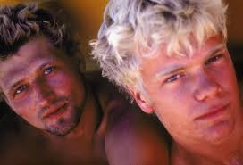 Cháy nắng mức độ 1.