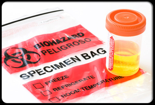 Bạn nên khám bác sĩ ngay lập tức nếu ra máu bất thường trong đờm, phân hoặc nước tiểu. Nó có thể là ung thư ruột kết, ung thư bàng quang hay đại tràng.