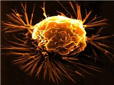 Trong các thử nghiệm , các nhà nghiên cứu Đại học Leicester nhận thấy rằng một hóa chất trong trầm hương giết chết các tế bào ung thư khó điều trị.