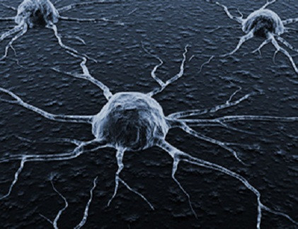 Protein K14 điều tiết sự phát triển của các tế bào di căn.