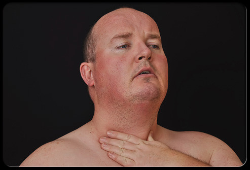 Nếu bạn cảm thấy khối u hoặc sưng ở các hạch bạch huyết dưới nách, cổ hay bất cứ nơi nào khác đều là lý do đáng để quan tâm.