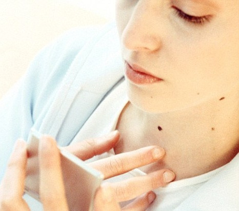 Bệnh thường xuất hiện dưới dạng nốt ruồi hoặc da có sắc tố kì lạ. Giải pháp thông thường để loại bỏ các khối u ác tính là mổ kết hợp với hóa trị hoặc xạ trị.