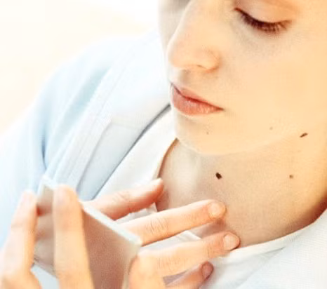 Bệnh thường xuất hiện dưới dạng nốt ruồi hoặc da có sắc tố kì lạ. Giải pháp thông thường để loại bỏ các khối u ác tính là mổ kết hợp với hóa trị hoặc xạ trị.