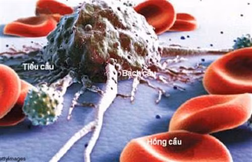 Nước ép cà rốt đã được chứng minh có thể tiêu diệt tế bào bệnh bạch cầu và ức chế sự phát triển của chúng trong một nghiên cứu năm 2011.