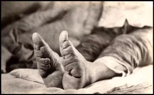 Bó chân gót sen. Chỉ khi có được đôi chân nhỏ nhắn, thon thả thì các thiếu nữ Trung Quốc mới mong lấy được chồng giàu sang. Quan niệm xuất phát từ điển tích xưa về gót sen vàng của hoàng hậu Triệu Phi Yến đã khiến bao thế hệ phụ nữ ở Trung Quốc phải hủy hoại, làm biến dạng bàn chân của mình ngay từ nhỏ. Trào lưu này thịnh hành gần 1.000 năm trước rồi bị hủy bỏ bởi tác hại lâu dài đối với sức khỏe.