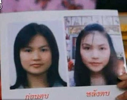 Thực tế có rất nhiều cô gái trẻ Thái Lan bỏ ra hàng trăm nghìn USD để tham gia các khóa học vỗ mặt, vỗ ngực. Theo nhiều nguồn tin, có những cô gái trẻ chỉ cần thực hiện 4 lần vỗ mặt đã có cằm V-line cực chuẩn giống như độn cằm. Tuy nhiên phương pháp này dường như khá hão huyền và đặc biệt là chi phí không hề rẻ.