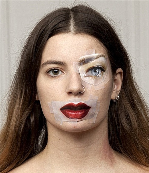 Phẫu thuật giọng nói. Khi cuộc sống phát triển, người dân bình thường cũng bắt đầu quan tâm nhiều đến việc làm sao có được một giọng nói hay. Trong một số trường hợp, cấy ghép dây thanh quản cũng được thực hiện qua một vết mổ ở cổ. Các bác sĩ cũng tiêm mỡ hoặc collagen vào dây thanh quản để khiến dây thanh quản trở nên tròn và linh hoạt hơn, có thể đem lại một giọng nói nghe có vẻ trẻ trung hơn.