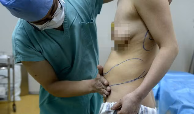 Một ngày, cô thức dậy và phát hiện một bên ngực đã tụt xuống lưng còn bên kia tụt xuống tận bụng.