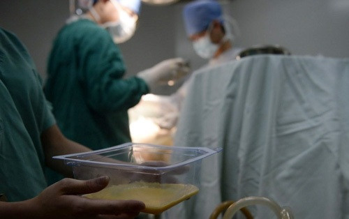 Dung dịch được hút ra khỏi cơ thể cô Tian Hui.