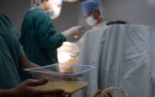 Dung dịch được hút ra khỏi cơ thể cô Tian Hui.