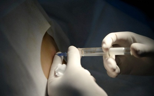 Các bác sĩ tiêm thuốc tê trước khi phẫu thuật loại bỏ chất độn ra khỏi cơ thể.