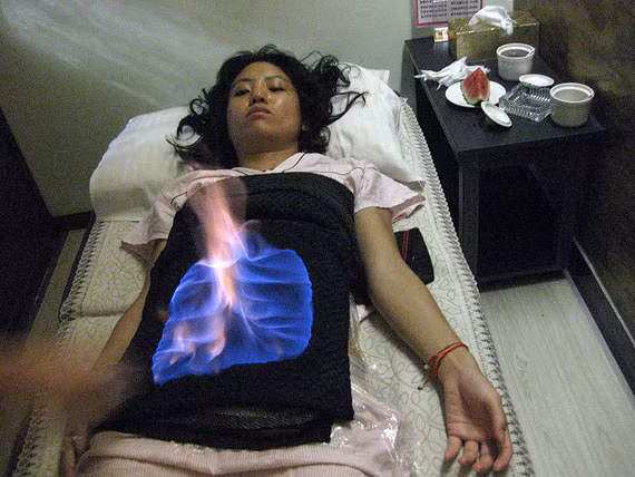 Một người phụ nữ đang giảm mỡ bụng bằng cách đốt lửa trên bụng.