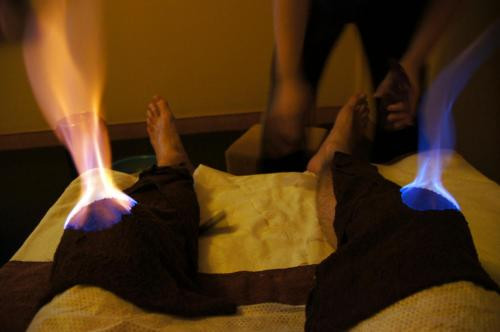 Massage mặt bằng lửa có tên gọi là Huǒ líao, người Trung Quốc còn khẳng định phương pháp trị liệu này có thể chữa khỏi chứng đau mỏi, giảm béo...