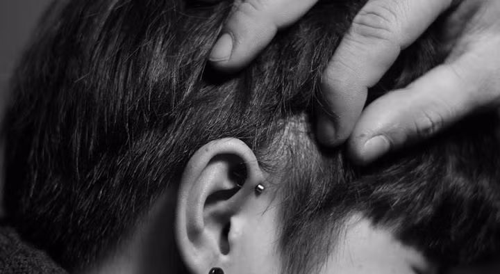 Một số trường hợp có thể gặp biến chứng nặng ở tai khi xỏ khuyên tai không đảm bảo vệ sinh và an toàn.