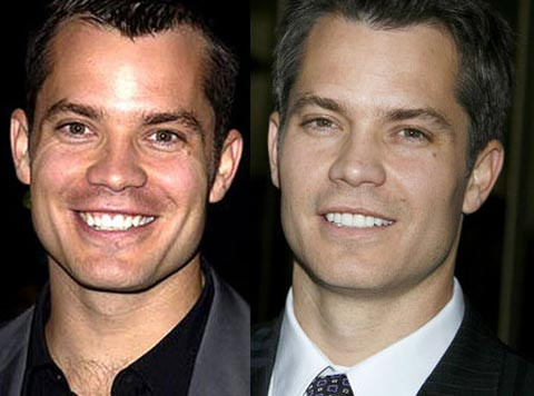 Timothy Olyphant. Nam diễn viên Timothy Olyphant đã tân trang lại khuôn mặt đẹp hơn lên rất nhiều, khiến cho cười duyên cũng duyên.