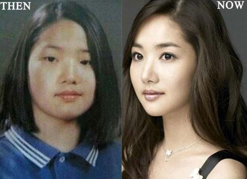 Người đẹp chuộng giao kéo và được mệnh danh "vịt hóa thiên nga" Park Min Young đứng đầu danh sách các Sao phẫu thuật thẩm mỹ trong làng Sao xứ Hàn. Vốn sở hữu nhan sắc khá nhạt nhòa nếu không muốn nói là có hạn chế, cô nàng đã nhờ cậy phẫu thuật thẩm mỹ để gọt hàm thon gọn, nâng mũi cao và xẻ 2 mí mắt, tại nên hình ảnh cuốn hút như hiện tại.