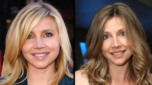 Sarah Chalke với đường nét khuôn mặt nhiều đổi khác.