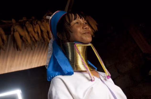 Trọng lượng của những chiếc vòng sẽ gây áp lực lên phần xương bả vai khiến vai bị biến dạng và phần cổ trông dài hơn.