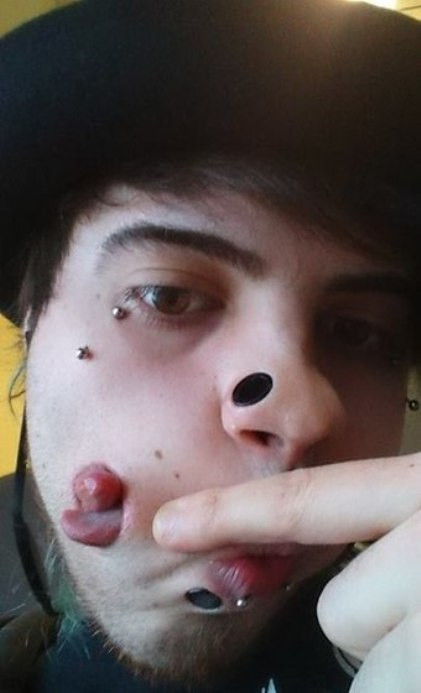 Không những nong lỗ khuyên trên má, chàng trai này còn xẻ lưỡi làm đôi.