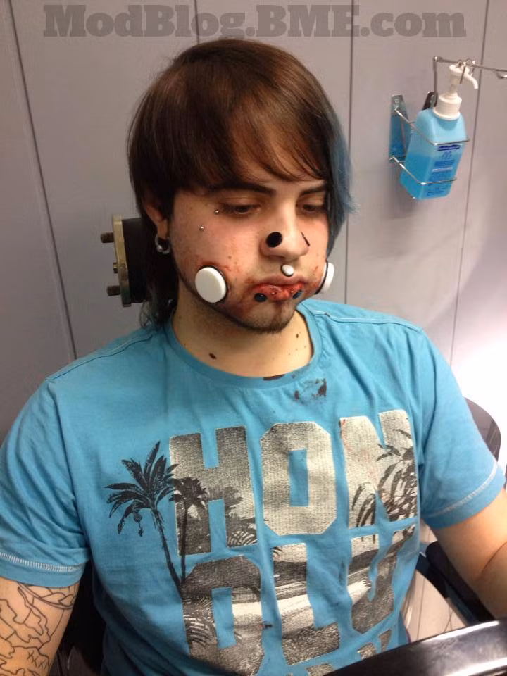 Trước đó 4 năm, Bodmodpunky từng xỏ khuyên má với kích thước mỗi lỗ 1,6mm. Sau đó, anh dần tăng kích thước cho 2 lỗ thủng từ 10, 18, 22 cho tới 30mm