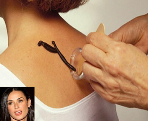 Trong một chương trình truyền hình Mỹ, ngôi sao của The Ghost đã tiết lộ bí quyết giúp cô trẻ hơn so với tuổi 51. Cô thừa nhận đã để cho đỉa hút máu của mình để giải độc và mang lại vẻ trẻ trung.