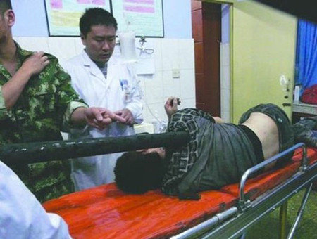 Vào ngày 16/4 vừa qua, một tài xế xe tải tại Trung Quốc đã thoát chết thần kỳ dù gặp phải một tai nạn nghiêm trọng khi bị một thanh gỗ dài đâm xuyên qua người nhưng may mắn không đi trúng tim.