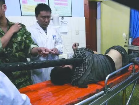 Vào ngày 16/4 vừa qua, một tài xế xe tải tại Trung Quốc đã thoát chết thần kỳ dù gặp phải một tai nạn nghiêm trọng khi bị một thanh gỗ dài đâm xuyên qua người nhưng may mắn không đi trúng tim.