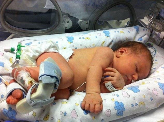 Sau khi sinh, phổi của Gracie ngập máu thay vì oxy. (Ảnh: dailymail) Sau khi sinh, phổi của Gracie ngập máu thay vì oxy. (Ảnh: dailymail)