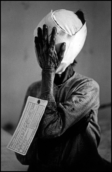 Người phụ nữ lớn tuổi đưa tay ôm mặt băng kín do bị thương trong chiến sự, 1967. Ảnh: Philip Jones Griffiths/ Magnum.