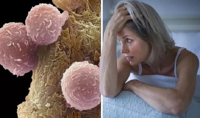 Thiếu ngủ làm tăng nguy cơ mắc 4 căn bệnh ung thư nguy hiểm Thieu ngu lam tang nguy co mac 4 can benh ung thu nguy hiem