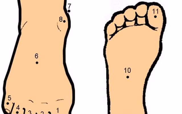 So huu 1 trong 6 not ruoi nay rat giau co, 3 doi phu quy