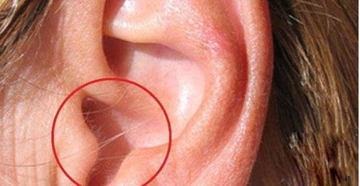 Lông mọc ở tai. Theo nhân tướng học, người có lông mọc dài ở khu vực tai là tướng cực kỳ may mắn. Người này được cho là có số hưởng, mang mệnh giàu sang, phú quý.