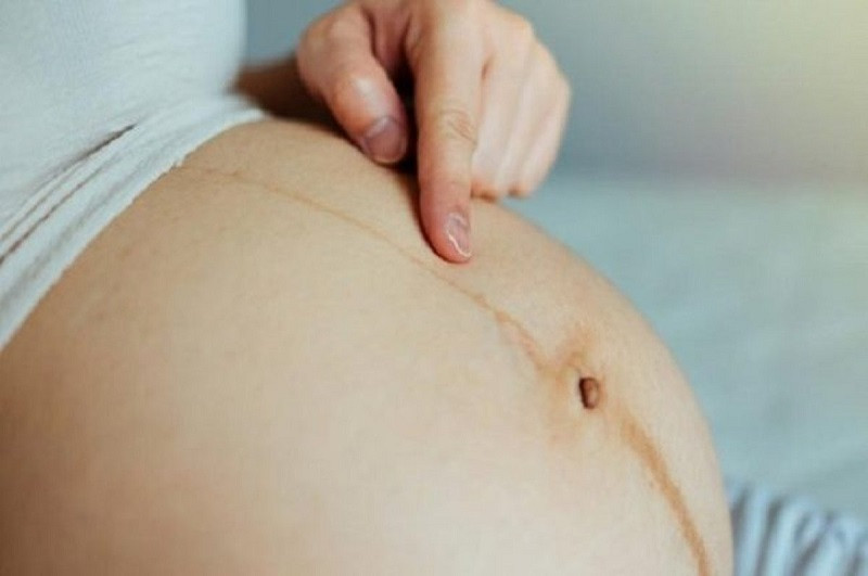 Lông mọc ở bụng. Theo nhân tướng học, bụng là nơi khởi nguồn của thánh khí. Nếu bụng có mọc lông chứng tỏ vận khí của người đó vô cùng tốt. Người có nhiều lông mọc ở bụng, đặc biệt là ở vùng rốn thường có tướng vương giả, mệnh đại phú quý. Chủ nhân của nết tướng này có cuộc đời hưng thịnh, làm đâu thắng đó.