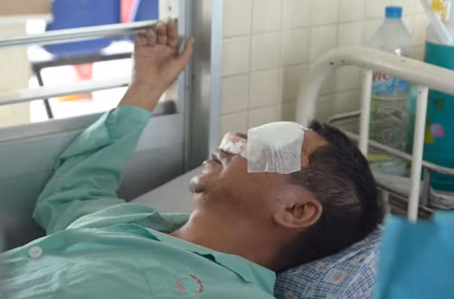 Ngay sau khi xảy ra vụ việc, nhà xe đã đưa nạn nhân vào Bệnh viện huyện Ea H’Leo cấp cứu rồi tiếp tục chuyển vào Bệnh viện Đa khoa tỉnh Đắk Lắk. Tuy nhiên, các bác sĩ tại đây nhận định mắt trái của nạn nhân bị vỡ nhãn cầu và không thể giữ lại. Tối 25/9, ông Lương tiếp tục được chuyển vào Bệnh viện Chợ Rẫy để điều trị. Ngoài bị ném đá hỏng mắt, ông Lương còn bị viên đá làm gãy xương mũi.