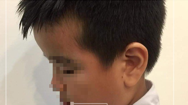 Hai Phong: Me HS lop 2 dang clip co giao tat toi tap, dung thuoc vut manh nhieu em