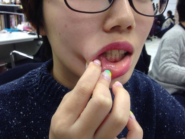 Nhung thoi quen lam tang nguy co ung thu mieng-Hinh-3