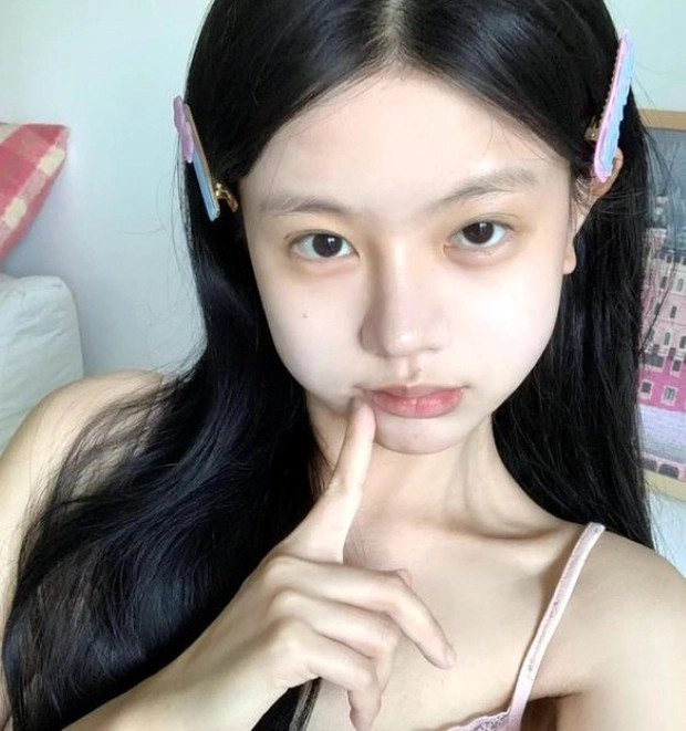 Nhung thoi quen lam tang nguy co ung thu mieng