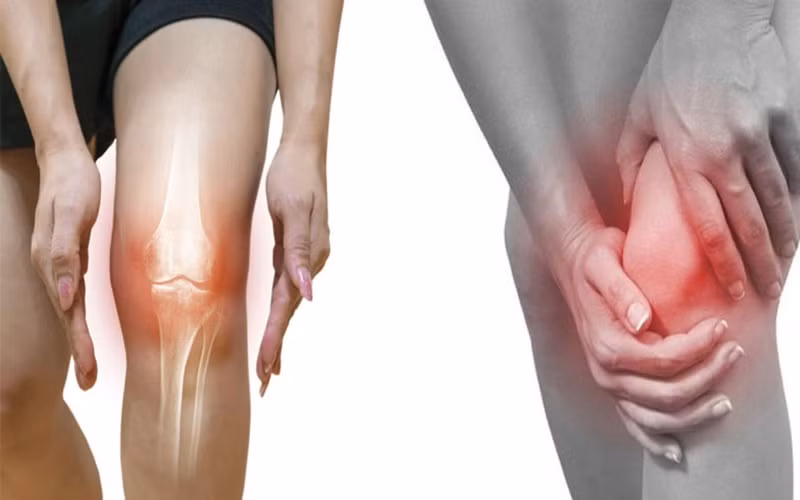 Giảm viêm khớp: Hàm lượng axit béo omega-6 có trong lá cây húng chanh có thể giúp giảm chứng viêm khớp và ngăn ngừa loãng xương.