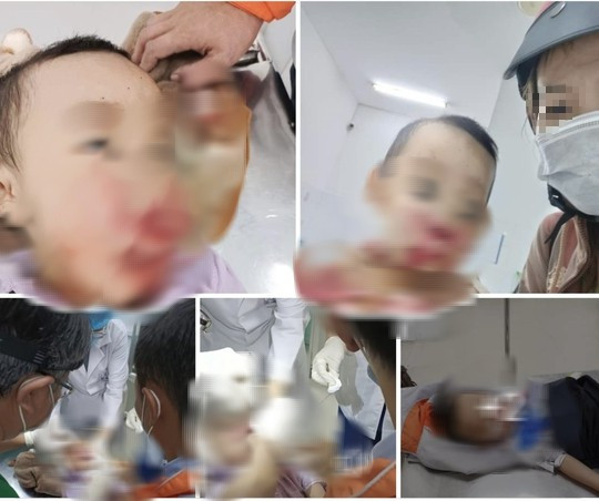 Làm rõ vụ người mẹ tố CSGT đánh trúng con nhỏ Lam ro vu nguoi me to CSGT danh trung con nho