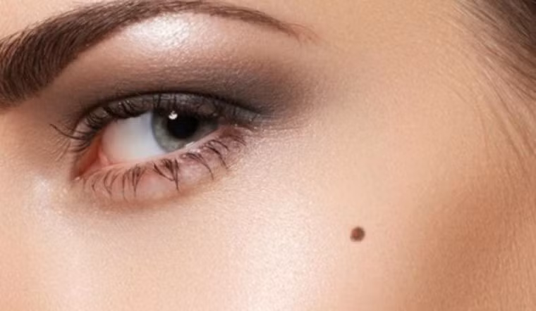  Tốt nhất là gò má hơi nhô lên, da thịt đầy đặn, không có đường ngang, dọc hay chéo và không có nốt ruồi ác tính. Có một nốt ruồi trên gò má, nếu là nốt ruồi tốt và có màu sẫm thì có nghĩa là bạn có thể gia tăng quyền lực và quyền hạn, tôn trọng ý kiến của cấp dưới và biết cách ủy quyền đầy đủ. 