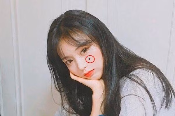  Những người như vậy có mối quan hệ cá nhân tốt và cực kỳ nổi tiếng trong các tình huống xã hội. Tuy nhiên, nếu màu sắc của nốt ruồi xỉn màu thì đó không phải là nốt ruồi tốt. Ngoài việc tượng trưng cho sự mất quyền lực, nó còn sẽ gặp khó khăn trong các mối quan hệ và cuộc sống, dễ bị người khác hiểu lầm, làm tổn thương, hoặc vu khống thông qua tin đồn.