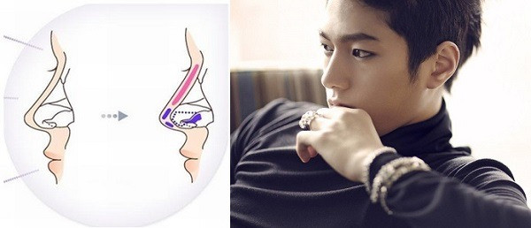  Đồng thời, những người mũi hếch thường có tính tình hào phóng không giữ được tiền của nên dù có của cải trong tay cũng sẽ khó lòng quản lý được.