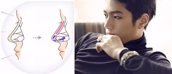  Đồng thời, những người mũi hếch thường có tính tình hào phóng không giữ được tiền của nên dù có của cải trong tay cũng sẽ khó lòng quản lý được.